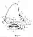 Fig. 03 - ORTHOSIS AND METHOD FOR THE PLACEMENT OF AN ORTHOSIS