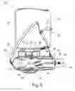 Fig. 06 - ORTHOSIS AND METHOD FOR THE PLACEMENT OF AN ORTHOSIS