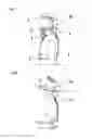 Fig. 02 - Cervical orthosis
