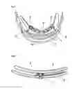 Fig. 05 - Cervical orthosis