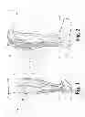 Fig. 02 - Adjustable-slider, equinus brace with toe wedge