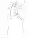Fig. 01 - Methods and systems for establishing retrograde carotid arterial blood flow