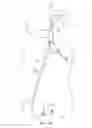 Fig. 03 - Methods and systems for establishing retrograde carotid arterial blood flow