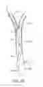 Fig. 07 - Methods and systems for establishing retrograde carotid arterial blood flow