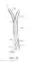 Fig. 08 - Methods and systems for establishing retrograde carotid arterial blood flow