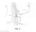 Fig. 11 - Methods and systems for establishing retrograde carotid arterial blood flow