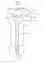 Fig. 02 - Stretch valve balloon catheter and methods for producing and using same