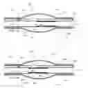 Fig. 16 - Stretch valve balloon catheter and methods for producing and using same