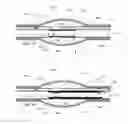 Fig. 20 - Stretch valve balloon catheter and methods for producing and using same
