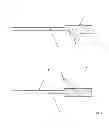 Fig. 02 - BALLOON CATHETER