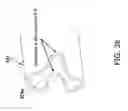 Fig. 37 - Medication administering device