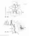 Fig. 02 - Minimally invasive lung volume reduction devices, methods, and systems