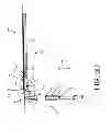 Fig. 07 - Medical device and method for injecting a fluid