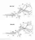 Fig. 40 - Device and methods for transvascular tumor embolization with integrated flow regulation