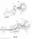 Fig. 43 - Device and methods for transvascular tumor embolization with integrated flow regulation