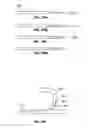 Fig. 46 - Device and methods for transvascular tumor embolization with integrated flow regulation