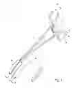 Fig. 02 - Microwave coaptive surgical sealing tool
