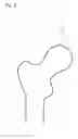 Fig. 09 - FRACTURE TREATMENT DEVICE