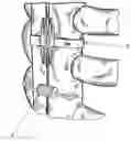 Fig. 01 - FLAT SUTURE BANDING SYSTEM AND METHODS