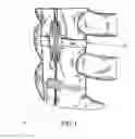 Fig. 02 - FLAT SUTURE BANDING SYSTEM AND METHODS