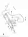 Fig. 07 - Depth controllable and measurable medical driver devices and methods of use