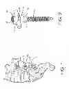 Fig. 02 - Screw driver with release for a multiaxial bone screw