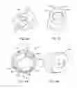 Fig. 07 - SHEATH FOR HAND-HELD AND ROBOTIC LAPAROSCOPES