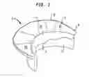 Fig. 02 - Apparatus and method for heart valve repair