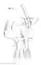 Fig. 07 - Apparatus and method for heart valve repair