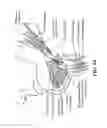 Fig. 06 - Method for modifying larynx position by trans-positioning muscle and electrode stimulation