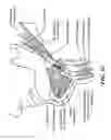 Fig. 07 - Method for modifying larynx position by trans-positioning muscle and electrode stimulation