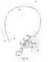 Fig. 02 - Implantable luminal devices