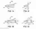 Fig. 02 - Embolectomy devices and methods for treatment of acute ischemic stroke condition