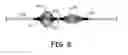 Fig. 09 - Embolectomy devices and methods for treatment of acute ischemic stroke condition