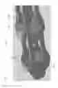 Fig. 02 - Laparoscopic devices and methods of using