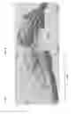 Fig. 06 - Laparoscopic devices and methods of using