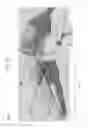 Fig. 07 - Laparoscopic devices and methods of using