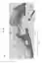 Fig. 09 - Laparoscopic devices and methods of using