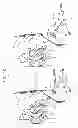 Fig. 05 - MINIMALLY INVASIVE SURGICAL TECHNIQUES