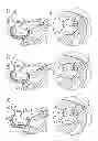 Fig. 09 - MINIMALLY INVASIVE SURGICAL TECHNIQUES