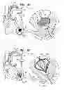 Fig. 10 - MINIMALLY INVASIVE SURGICAL TECHNIQUES