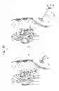 Fig. 13 - MINIMALLY INVASIVE SURGICAL TECHNIQUES