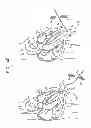Fig. 14 - MINIMALLY INVASIVE SURGICAL TECHNIQUES