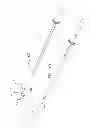 Fig. 15 - MINIMALLY INVASIVE SURGICAL TECHNIQUES
