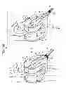 Fig. 17 - MINIMALLY INVASIVE SURGICAL TECHNIQUES