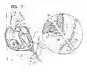 Fig. 23 - MINIMALLY INVASIVE SURGICAL TECHNIQUES