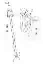 Fig. 32 - MINIMALLY INVASIVE SURGICAL TECHNIQUES