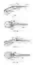 Fig. 09 - Suture passing surgical instrument