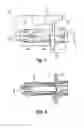 Fig. 02 - Lateral spinous process spacer with deployable wings