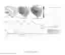 Fig. 12 - Method for low-voltage termination of cardiac arrhythmias by effectively unpinning anatomical reentries